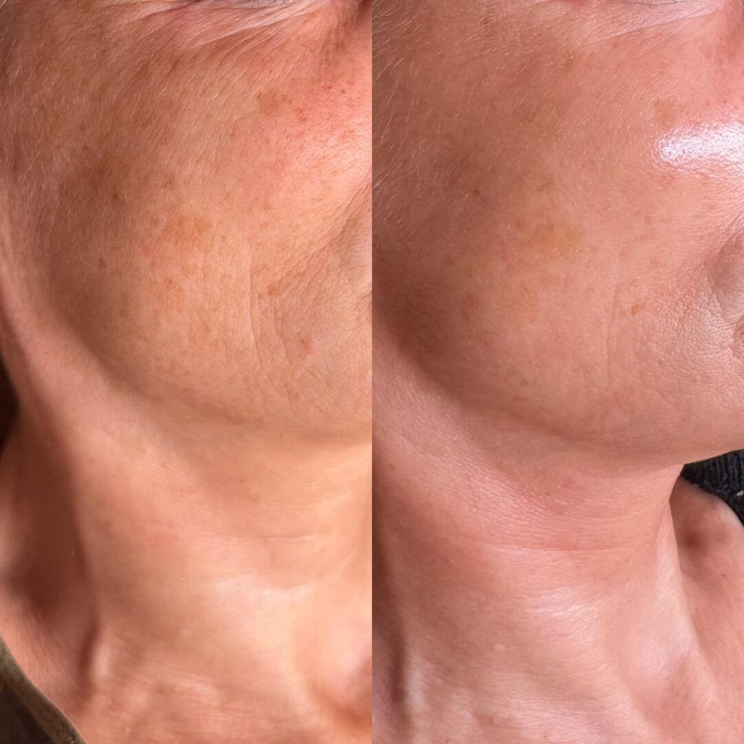 Elisir oro 24k - Radice di ginseng, niacinamide e vitamina C