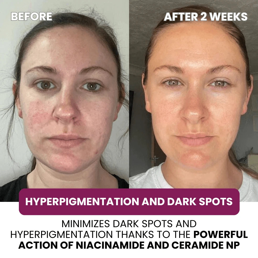 Collagen & Niacinamide Restoring Mask