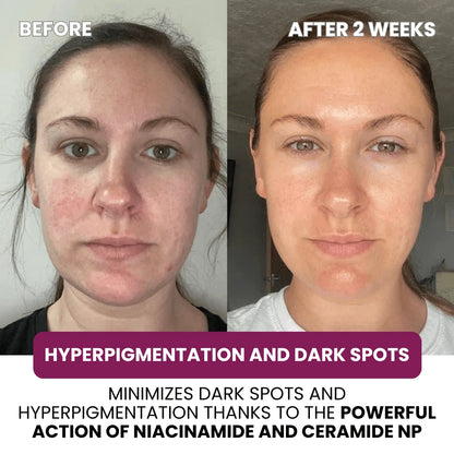 Collagen & Niacinamide Restoring Mask