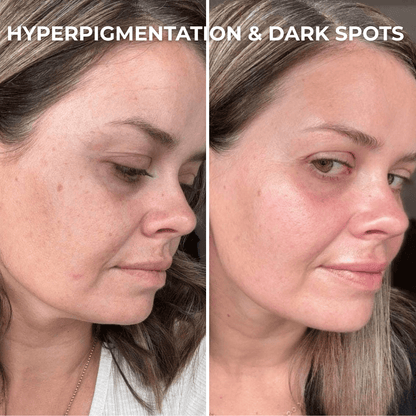 PDRN Collagen Peptides Hydrogel Mask